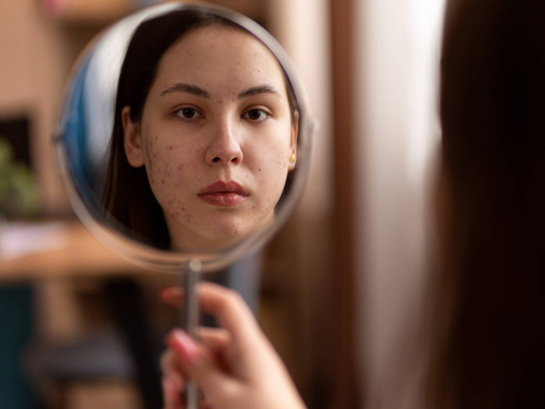 Understanding Skin Pigmentation & Products That Helps