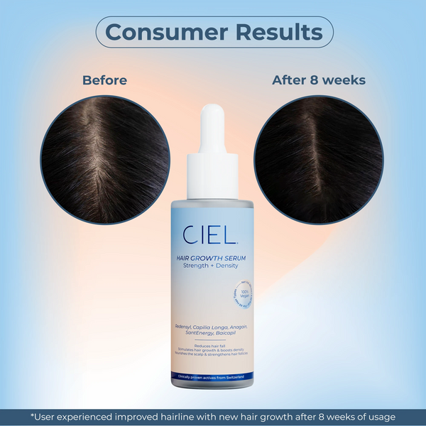 Hair Growth Serum